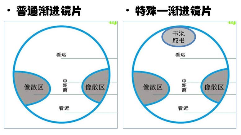 漸進(jìn)多焦鏡的原理與應(yīng)用，3個(gè)光區(qū)，看遠(yuǎn)近只需一副